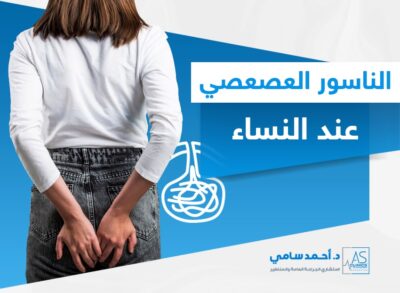 الناسور العصعصي عند النساء