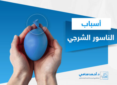 اسباب الناسور