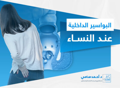 اعراض البواسير الداخليه للنساء