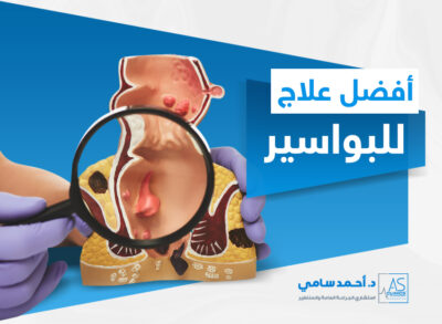 افضل علاج للبواسير