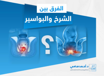 الفرق بين الشرخ والبواسير
