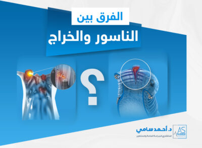 الفرق بين الناسور والخراج