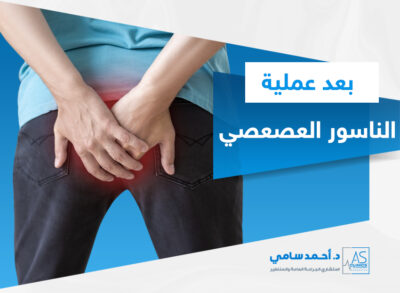 الناسور العصعصي بعد العملية