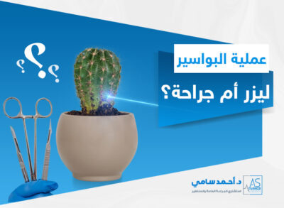 ايهما افضل عملية البواسير بالليزر ام الجراحة