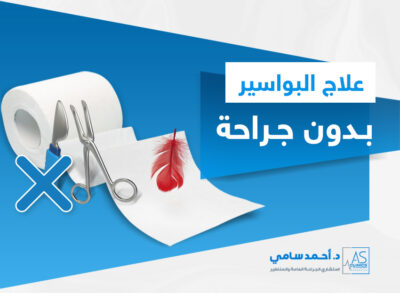 علاج البواسير بدون جراحة