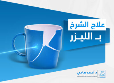 علاج الشرخ بالليزر