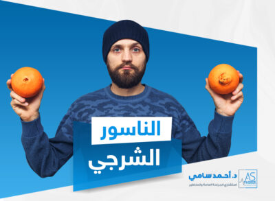 علاج الناسور الشرجي