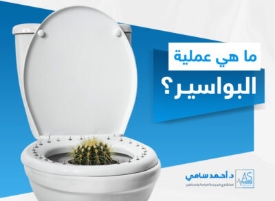 هي عملية البواسير