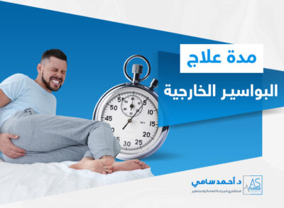 مدة علاج البواسير الخارجية