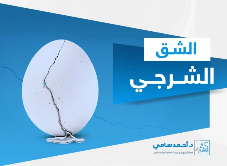 الشق الشرجي