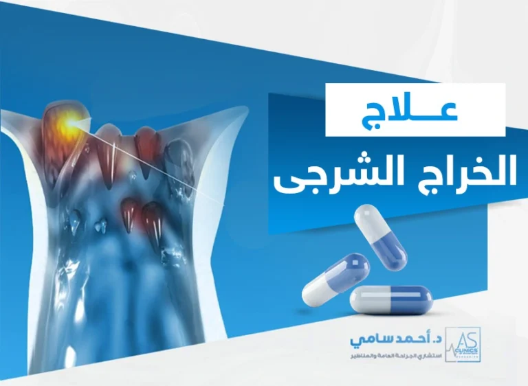 علاج الخراج الشرجى​