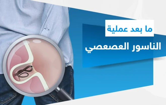 ما بعد عملية الناسور العصعصي​
