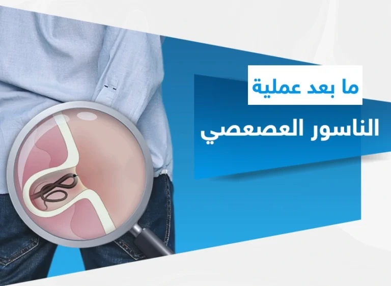 ما بعد عملية الناسور العصعصي​